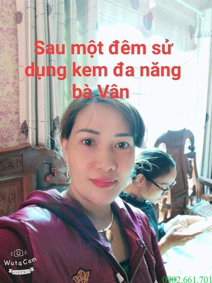 Dùng Kem Đa Năng Với Bệnh Zona