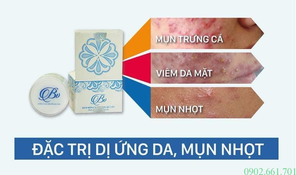 Kem-Trị-Mụn-Đông-Y-Bà-Vân-TPHCM.